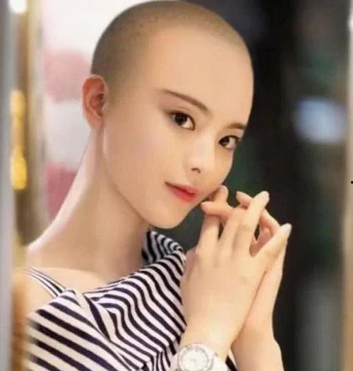 明星网红脱发,揭秘脱发背后的真相与应对之道